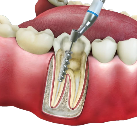 Endodontia