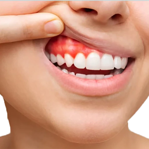 Periodontia