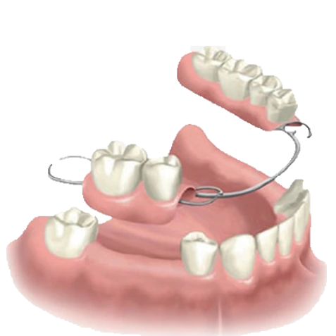 Próteses Odontológicas